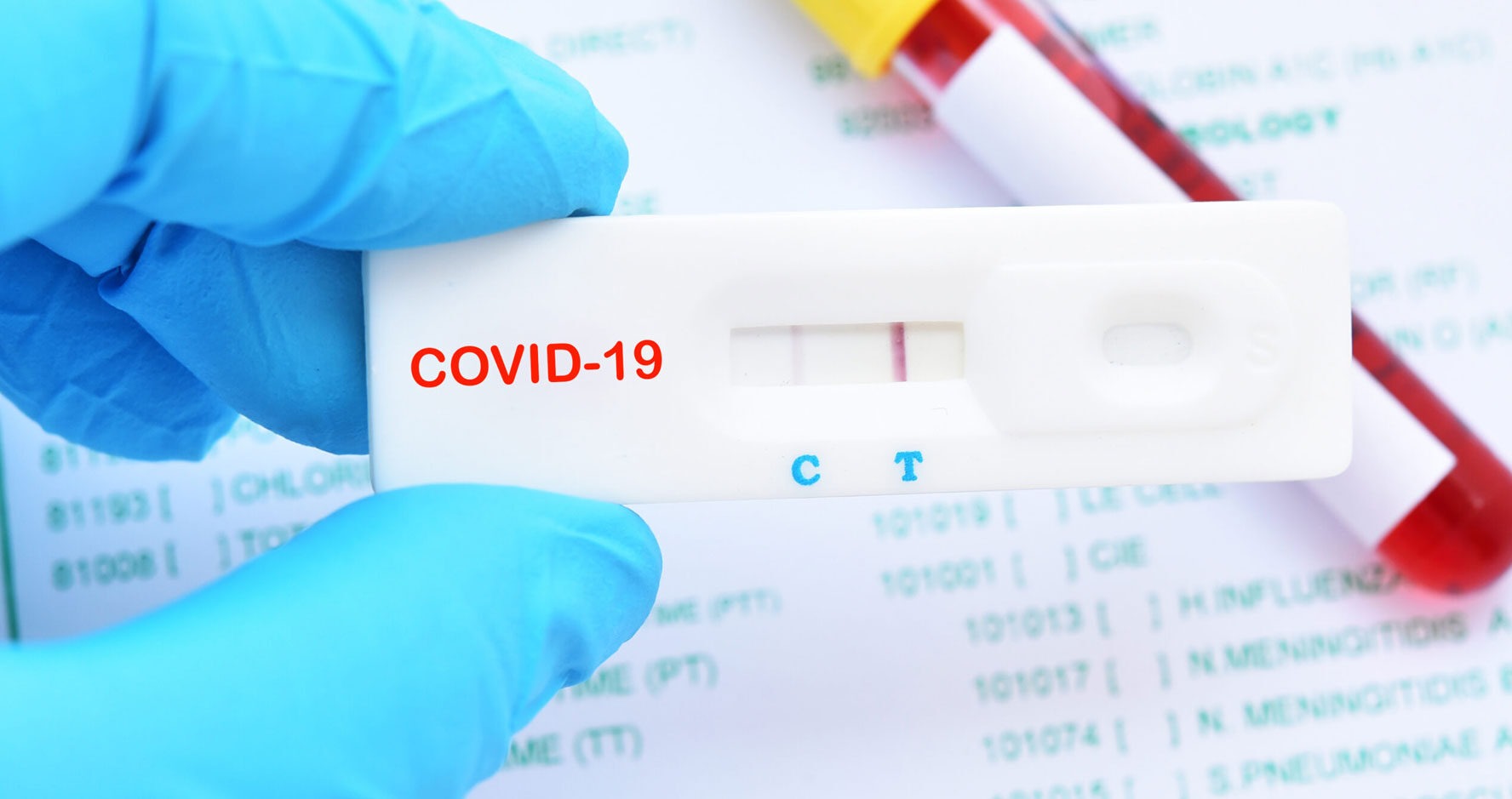 Scientists Unable To Properly Track Pandemic Due To COVID-19 Testing Plunge