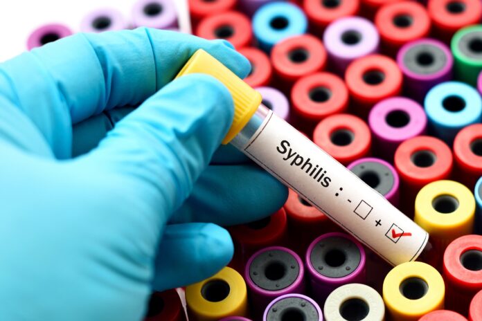 STD Rates in The U.S. Are 'Out of Control' - Syphilis & HIV On The Rise