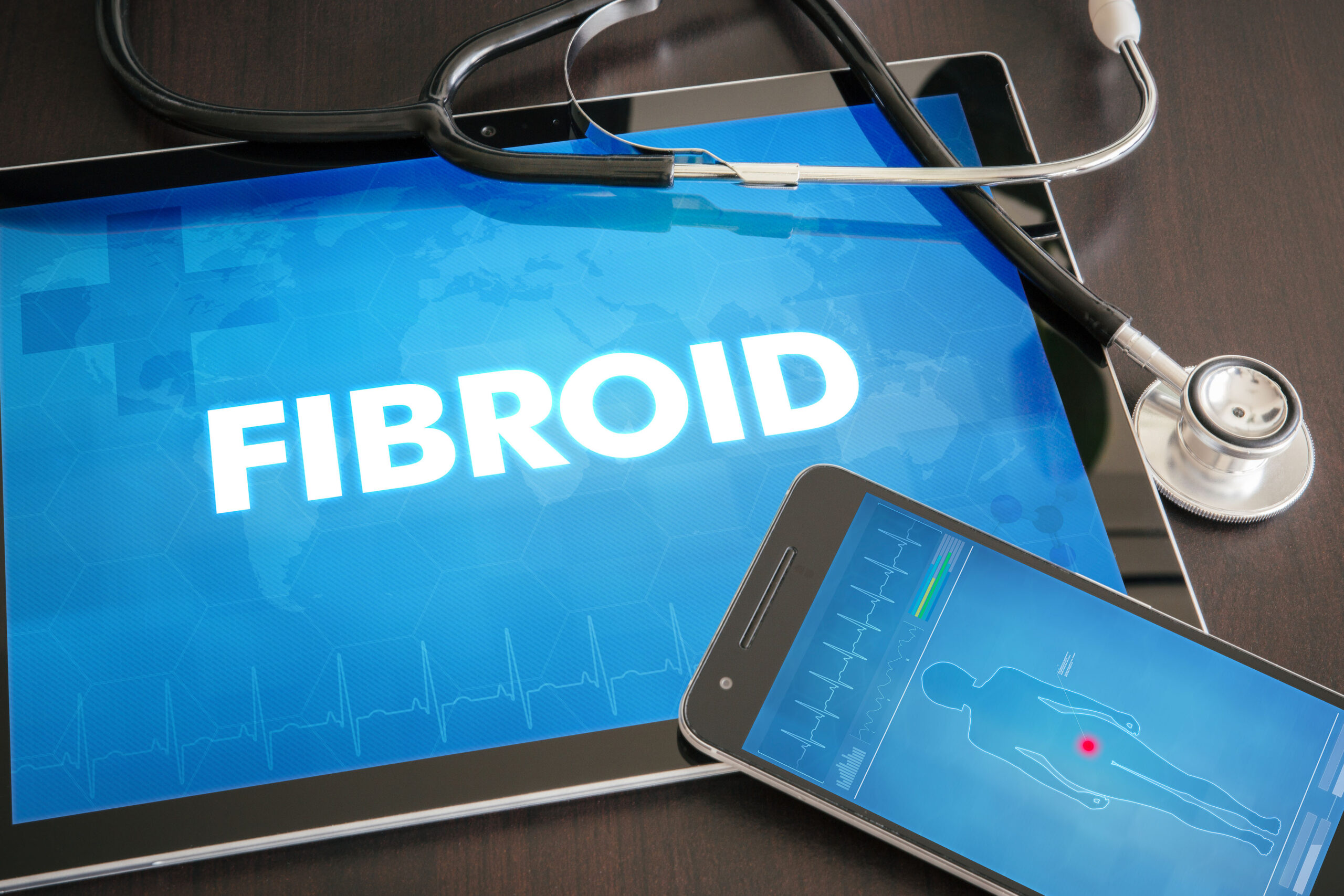 Empowering Women: Understanding Fibroids and Taking Control of Your Health
