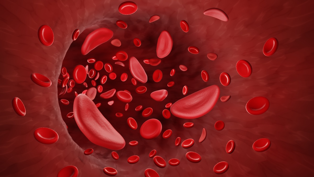 Breaking Down The New Sickle Cell Gene Therapies (And Reactions From SCD Patients)
